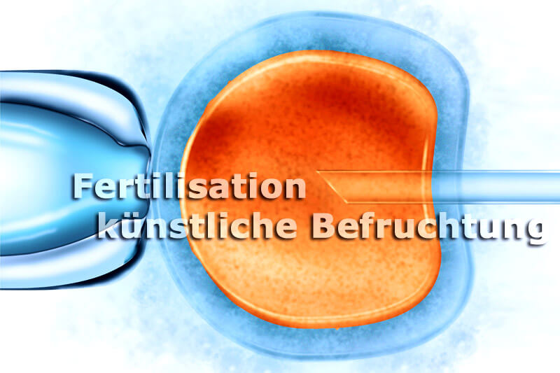 Künstliche Befruchtung - In-Vitro-Fertilisation