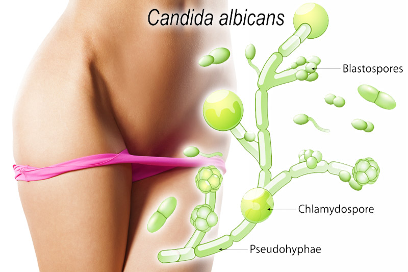 Candida albicans – Verursacher von Genitalmykosen 